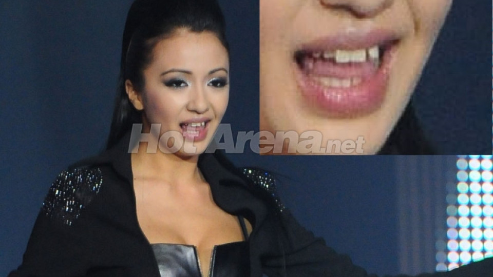 Какво се случва със зъбите на Ани Хоанг? (снимка)