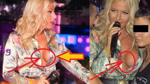 Силиконът на Камелия ТОТАЛНО се РАЗКАПА! ФОТО
