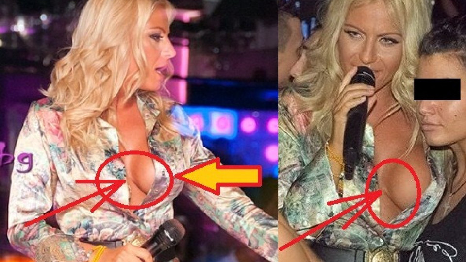 Силиконът на Камелия ТОТАЛНО се РАЗКАПА! ФОТО