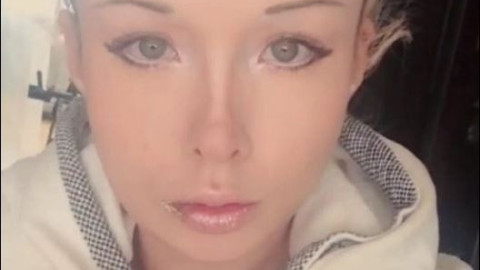 Живата Барби в болница: Опитаха се да ме убият! 