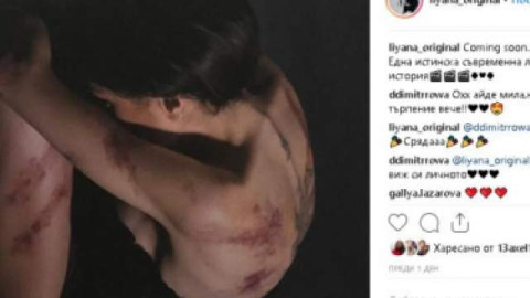 Лияна се показа насинена и окървавена!(Кой посегна на певицата)