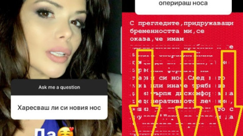 Преслава проговори: Призна защо си е кръцнала носа!(Виж причината)