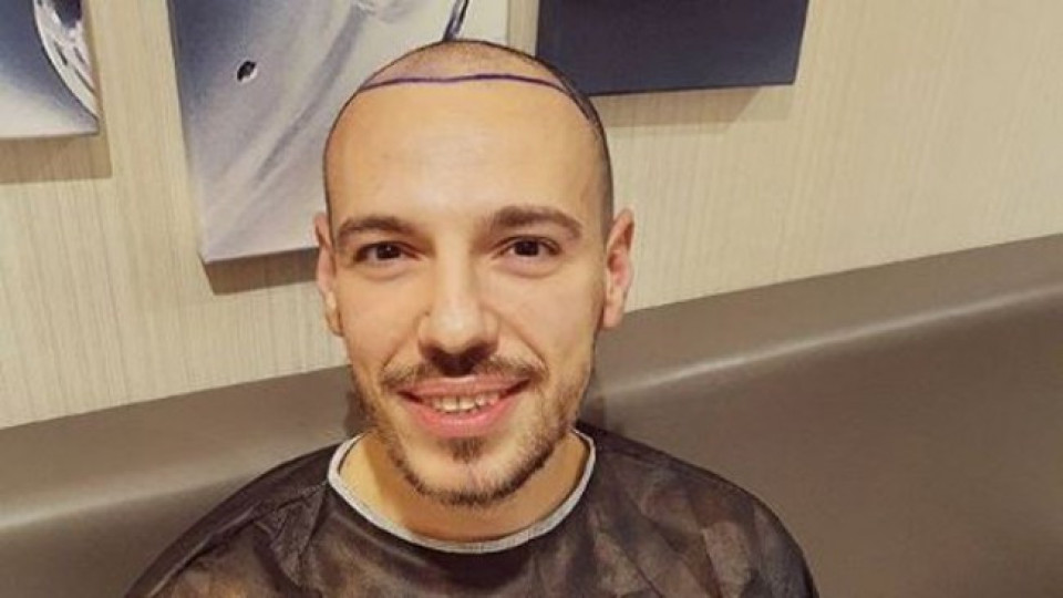 Даниел Петканов си присади коса в Истанбул