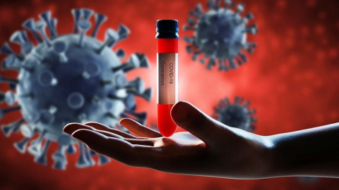Британски медици разкриха в комбинация с кои заболявания COVID-19 е най-смъртоносен