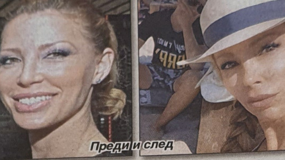 Ирен Онтева отново се реновира:Този път го отнесе носът й!(Виж още)