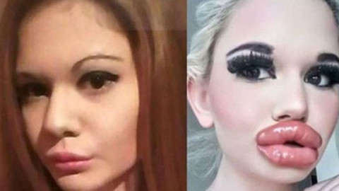 Андреа от Бургас счупи рекорда: За 21-ви път коригира джуките си!(Виж още)