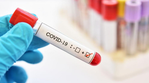 СЗО с тежки признания за COVID-19
