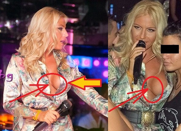 Камелия показа деформиран бюст