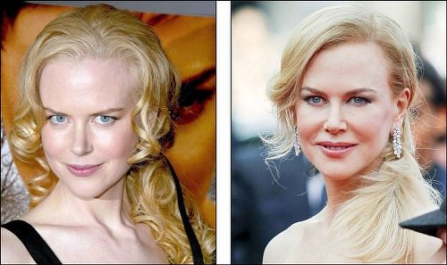 Никол Кидман (Nicole Kidman) преди 10 години и днес