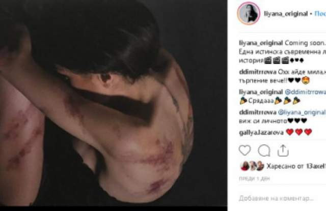 Лияна се показа насинена и окървавена!(Кой посегна на певицата)