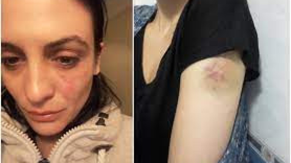 Ужас: Диана Димитрова от „Откраднат живот“ жертва на домашно насилие!