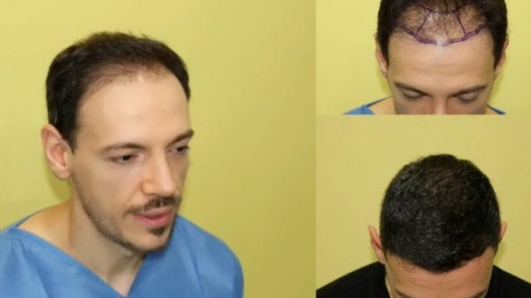 Лудия репортер най-после може да се похвали с гъста коса