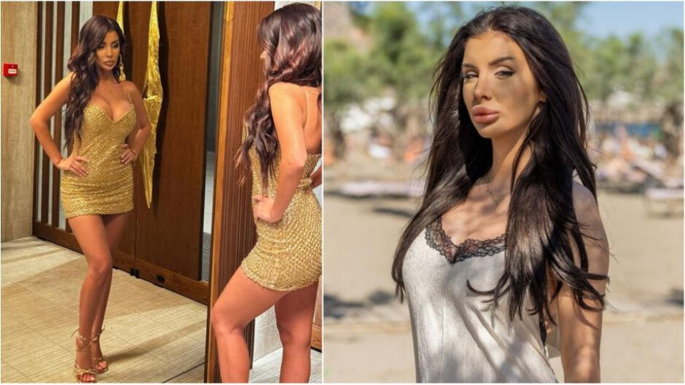 Габриела от „Ергенът“ разкри истината за тунинга и операциите си